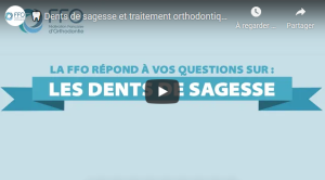 🦷 Dents de sagesse et traitement orthodontique : Que faire ?